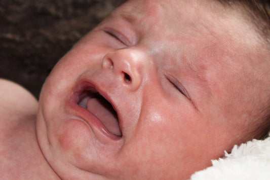 Comprendre et Traiter frein de langue bébé : Une Anomalie Congénitale Impactant la Langue